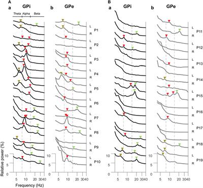 Frontiers Resting State Pallidal Cortical Oscillatory Couplings